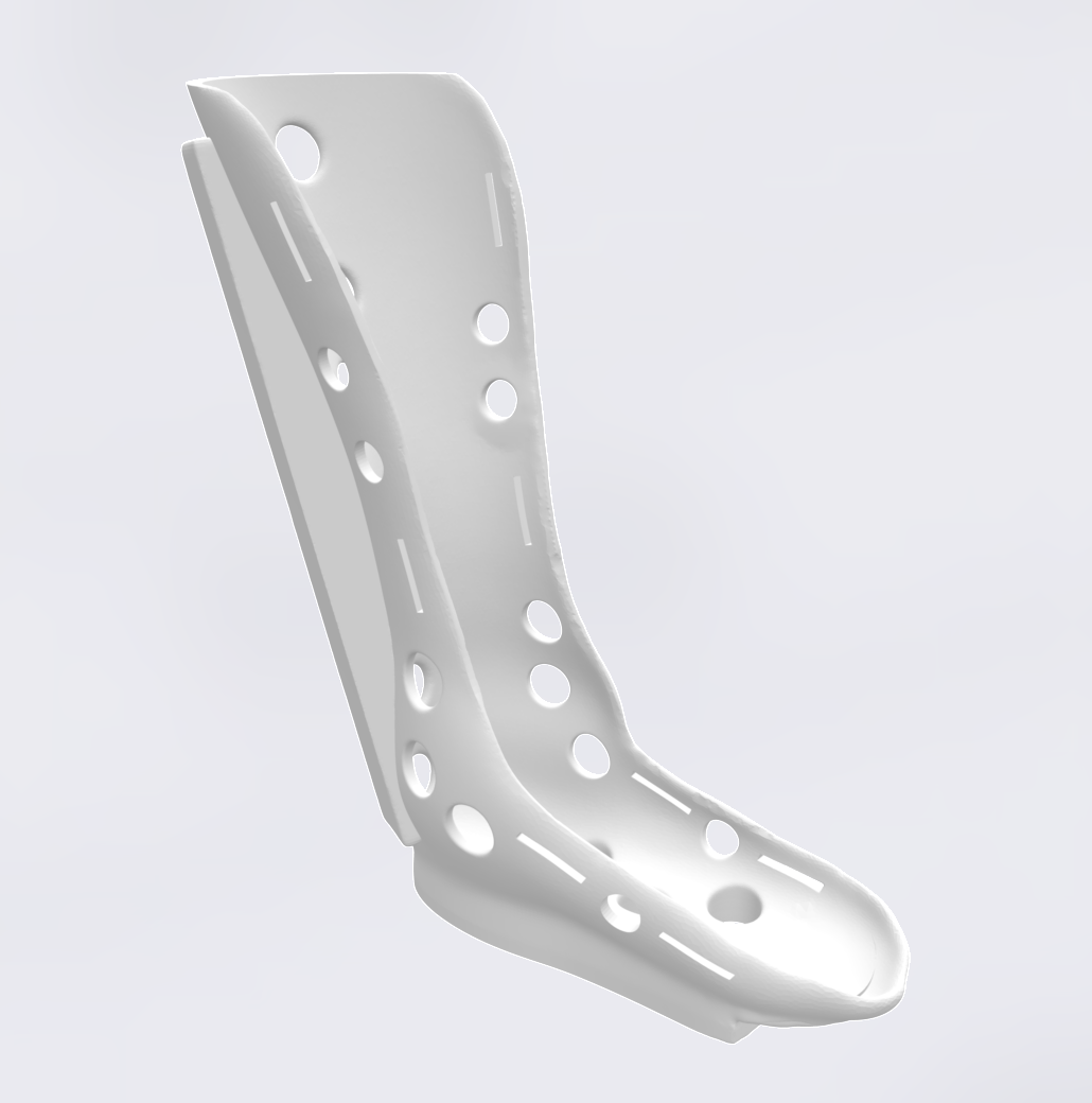 Custom 3D printed leg orthosis from 3D CURE