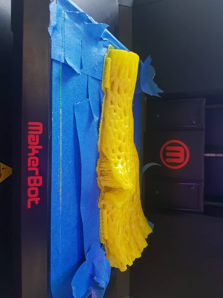 Design and fitting workflow for a 3D printed orthosis